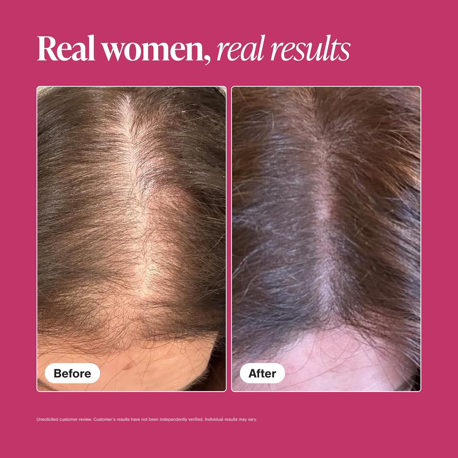 Viviscal Hair Growth Supplement for Women – 180 Tablets | Clinically Proven Hair Thickening Pills